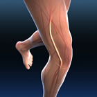 Upper leg arteries (superfiical femoral and popliteal)